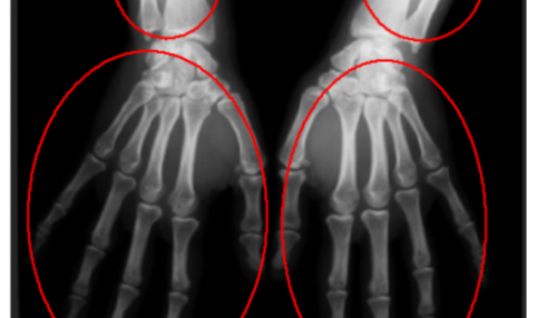 فیلم آموزش پیاده سازی الگوریتم قطعه بندی LevelSet در متلب + سورس کد متلب